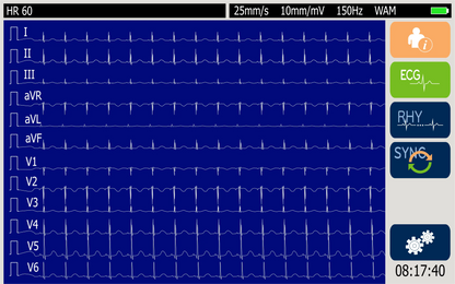 Welch Allyn ELI 280 10in Touchscreen Display