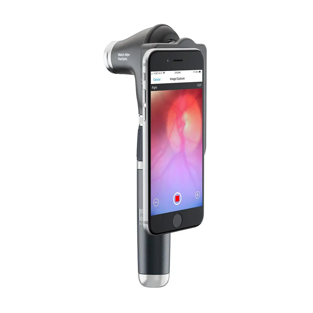 PanOptic Plus Ophthalmoscope Digital Imaging