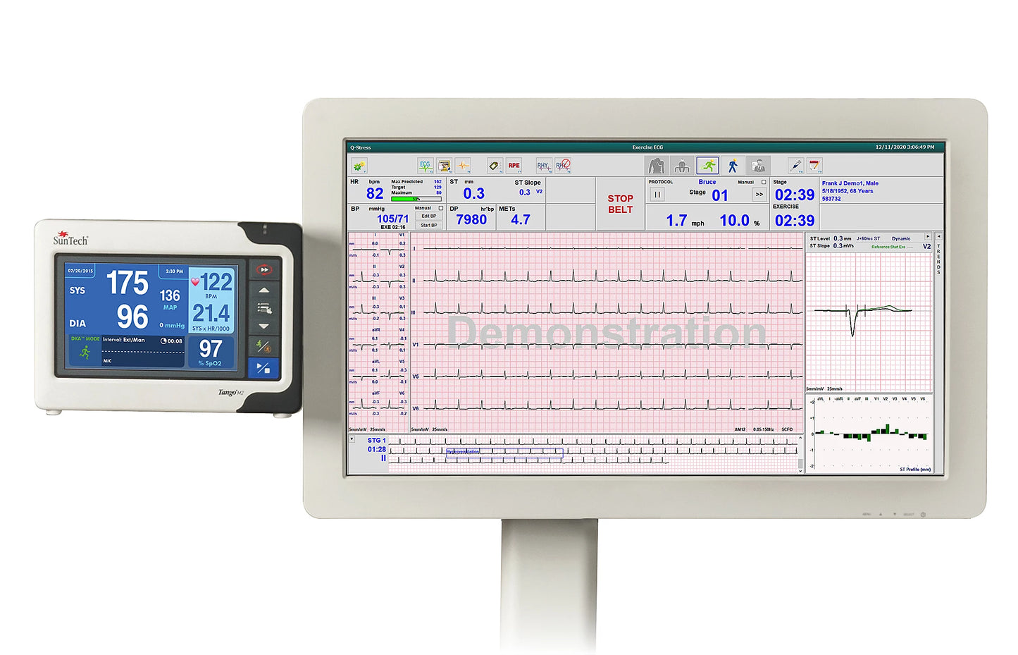 Q-Stress System 24" ELO Touchscreen Monitor